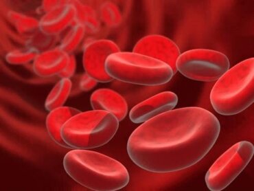 Anemia sideropenica e dieta cosa non può mancare Vivere più sani