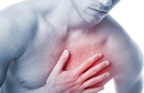 Quali sono i sintomi dell'infarto?