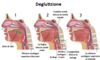 Manovra di Heimlich in caso di soffocamento