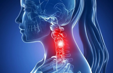 Problemi alla cervicale: prevenzione e cura