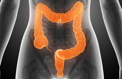 Colon irritabile