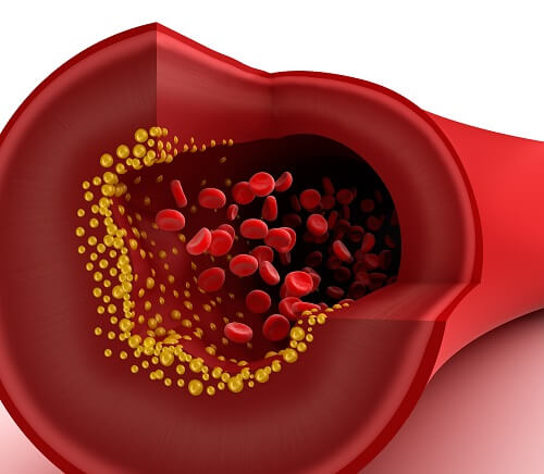 Arteria vista in sezione e globuli rossi