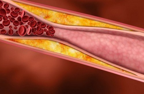 dieta per ridurre il colesterolo e i trigliceridi dieta per ridurre il colesterolo e i trigliceridi