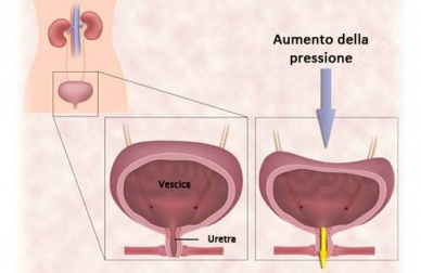 Esercizi per l'incontinenza urinaria della donna