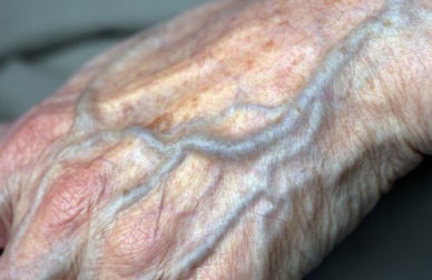 Circolazione nelle mani: come migliorarla