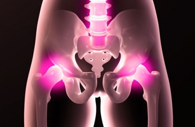 Dolore alle anche nelle donne: cause e rimedi