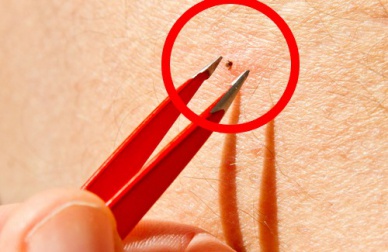 Zecche: un pericolo per umani ed animali