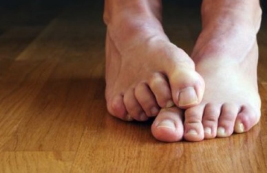 Micosi delle unghie: consigli e rimedi naturali