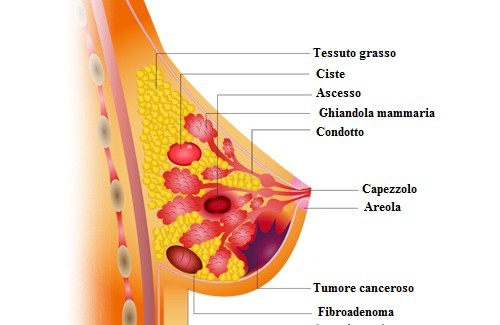 Alimenti che aiutano a prevenire il cancro