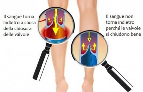 Migliorare la circolazione di gambe e braccia