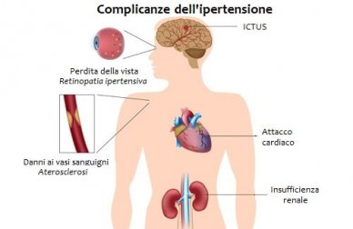I migliori alimenti contro l'ipertensione arteriosa