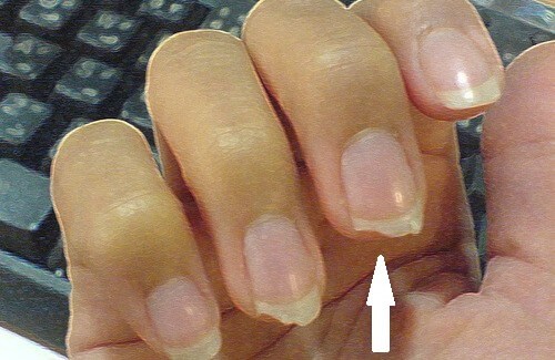 Come evitare che le unghie si spezzino