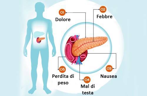Problema al pancreas: sintomi, cause e prevenzione