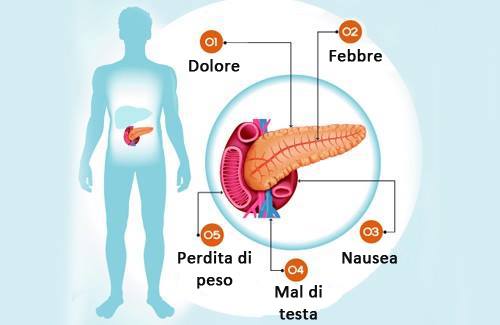 Problema Al Pancreas Sintomi Cause E Prevenzione Vivere