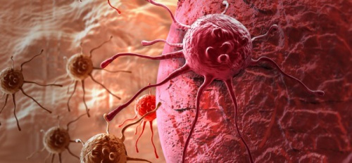 sintomo di perdita di peso cancro alla vescica sintomo di perdita di peso cancro alla vescica