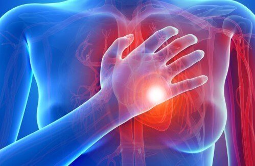 Malattie cardiache nelle donne: sintomi principali