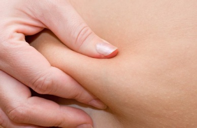 Grasso delle gambe: consigli per ridurlo