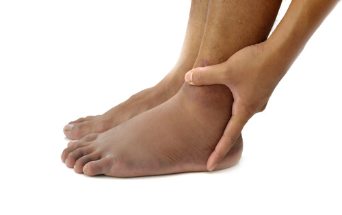 piedi gonfi3