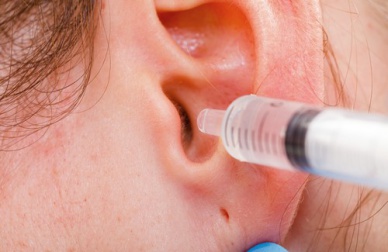 Il modo giusto di pulire le orecchie