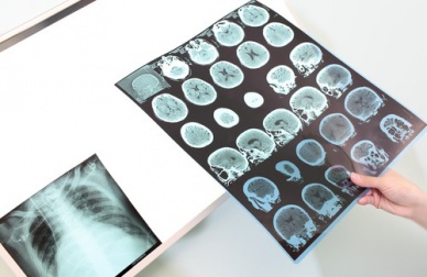 Dormire bene per rigenerare la memoria