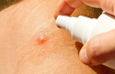 Repellenti per le zanzare: i migliori rimedi naturali