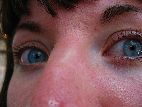 Viso femminile con punti neri in primo piano