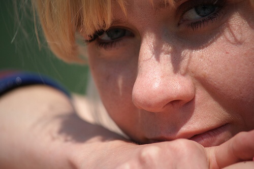 Viso femminile con punti neri