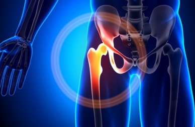 Alimenti decalcificanti: ecco i principali