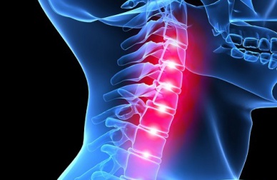 Consigli per alleviare il dolore cervicale