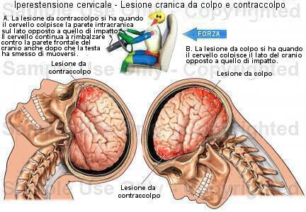 Urti leggeri e forti alla testa