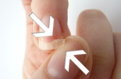 Unghie fragili: cause e rimedi da preparare in casa