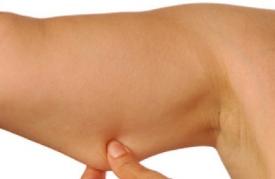 Braccia flaccide: consigli per tonificarle