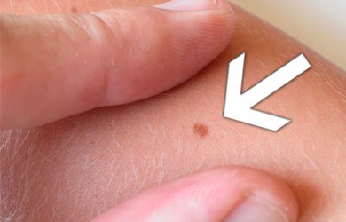 Nei pericolosi: l'importanza di saperli identificare