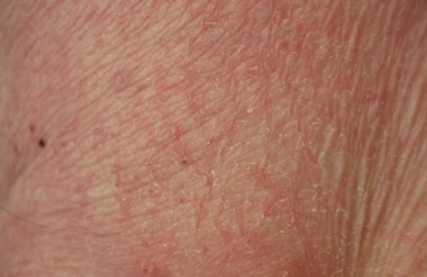 Alimenti ed integratori per la pelle secca e spenta