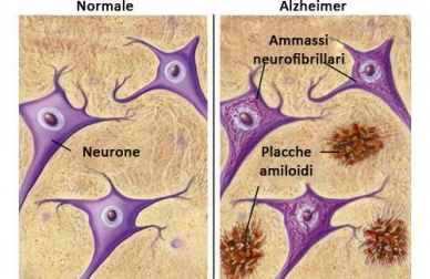 Alimenti che ci proteggono dal morbo di Alzheimer: 6 consigli