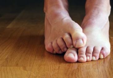 Rimedi naturali per l’onicomicosi di mani e piedi