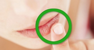 Deficit di vitamine: sintomi che lo indicano