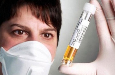 Colore delle urine, un indicatore della salute