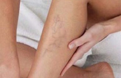 Controllare la cattiva circolazione con semplici consigli