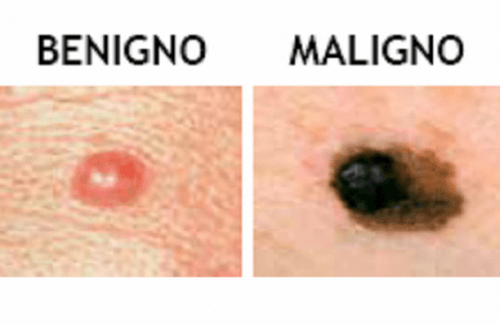 Tutto quello che c'è da sapere sui nei