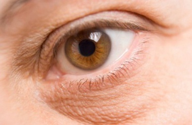 Schiarire o eliminare le occhiaie: come fare?