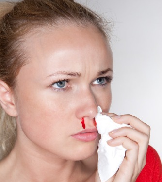 Donna che perde sangue dal naso
