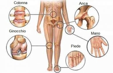 Il dolore articolare: 5 consigli per eliminarlo