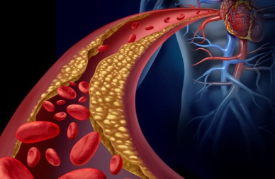 Ridurre i trigliceridi naturalmente: ecco come fare