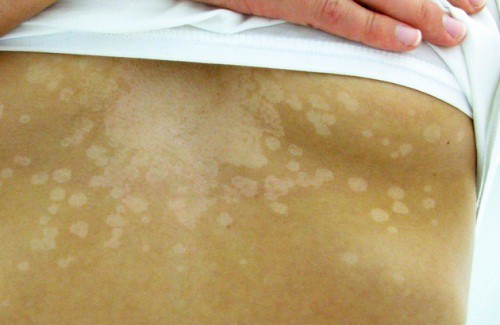 La pelle: segnali che indicano un problema