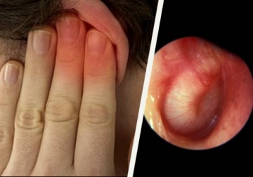 Infezioni alle orecchie: come trattarle