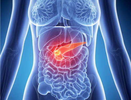 L'infiammazione del pancreas può causare dolore alla parte destra dell'addome