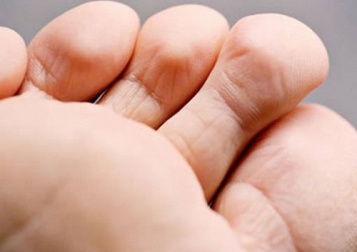 Trattamento e prevenzione del cattivo odore dei piedi