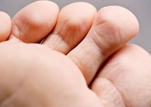 Trattamento e prevenzione del cattivo odore dei piedi