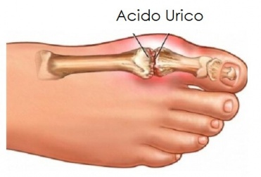 Controllare l'acido urico con la frutta
